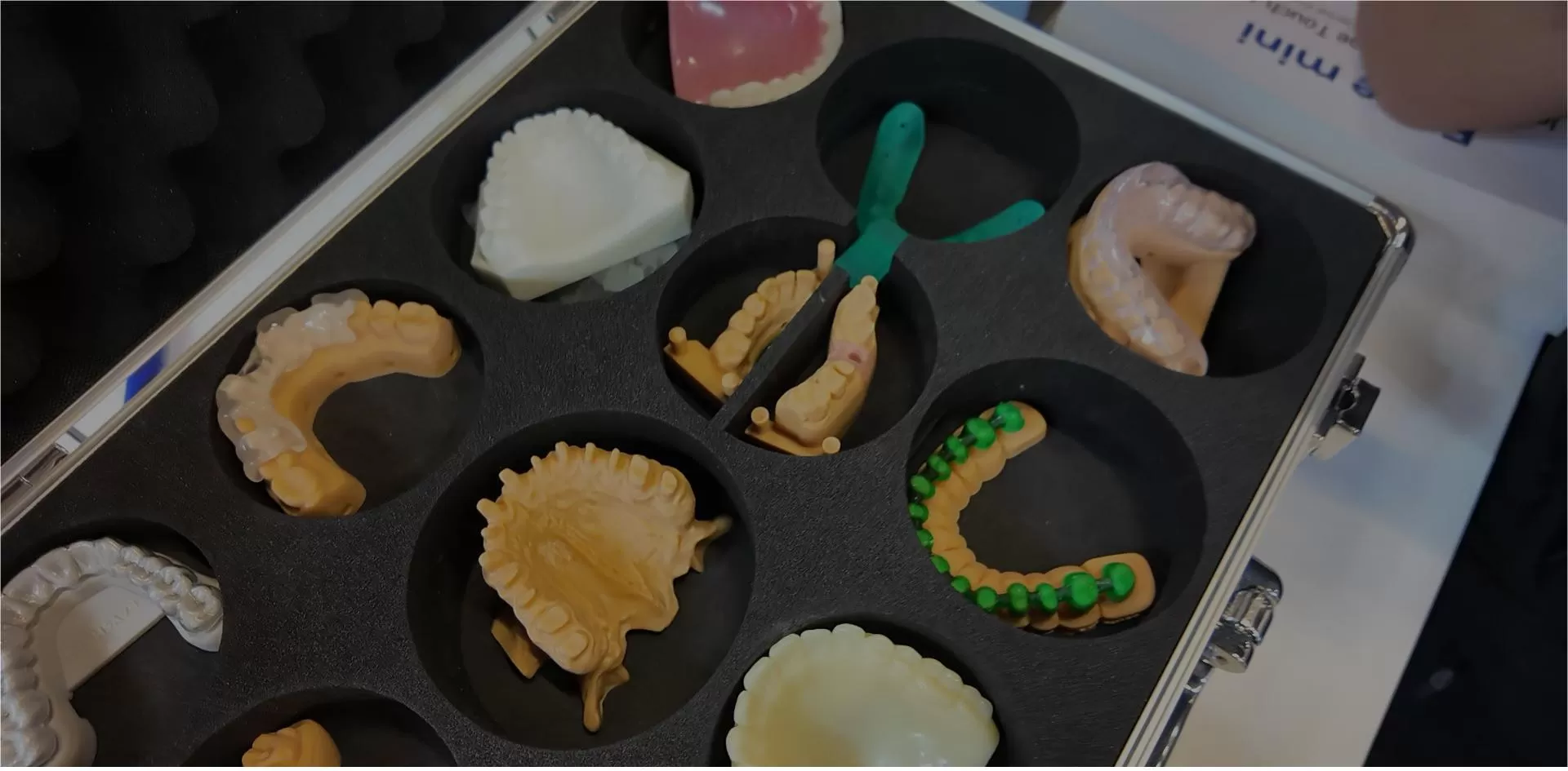 ข่าว rayshape